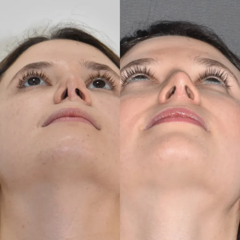 img 3034